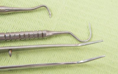 A korrózióálló védelem kulcsa – Állítsa helyre az acél passzív rétegét!